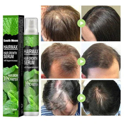 Sérum Capilar Hair Maximum™ - Prevenção de Queda e Crescimento de Cabelos Até 10x Mais Rápido